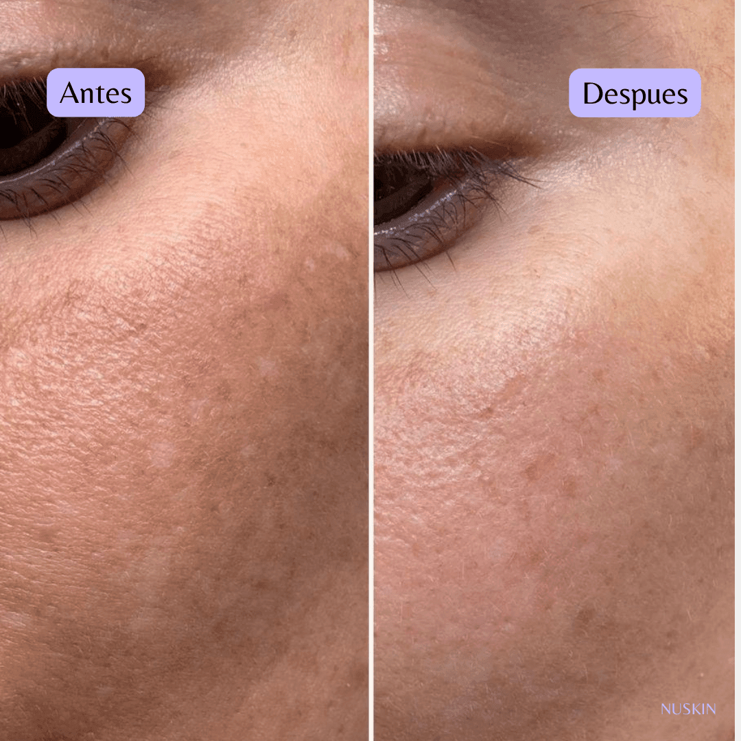 GALVÁNICA FACIAL - nunzia.mx