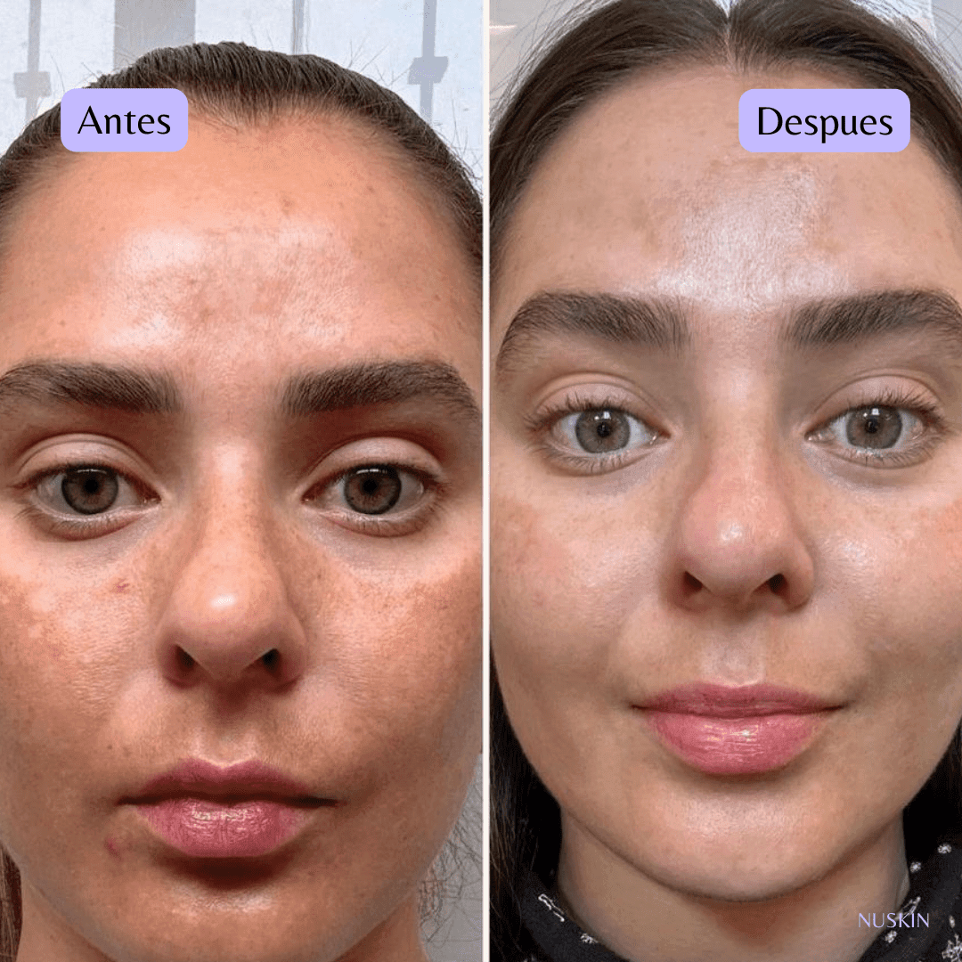 GALVÁNICA FACIAL - nunzia.mx