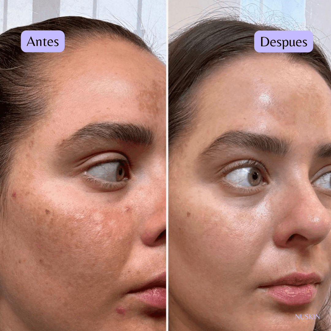 GALVÁNICA FACIAL - nunzia.mx