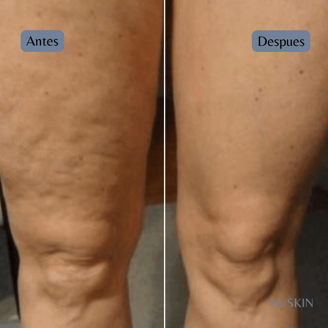 WellSPA Essentials BIENESTAR (tecnología piel)