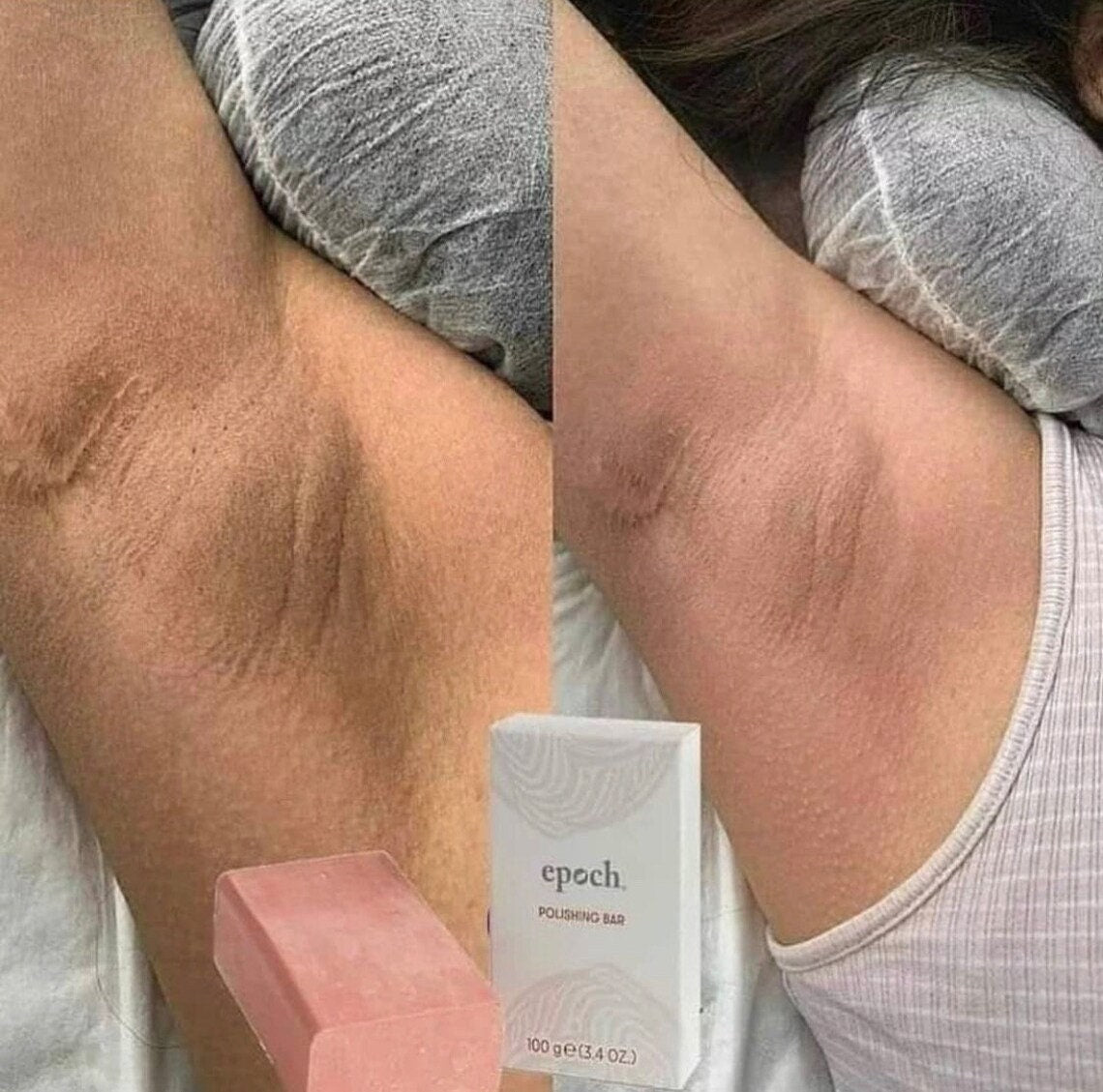 Polishing Bar EPOCH (jabón despigmentante)